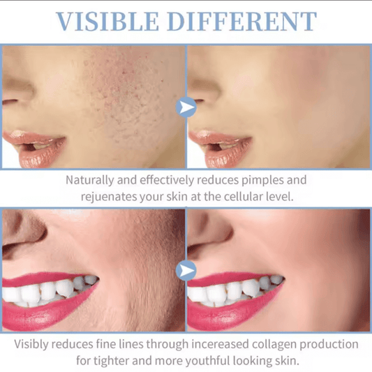DERMAVOLT HF PRO™ - RADIANCE WAND