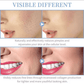DERMAVOLT HF PRO™ - RADIANCE WAND