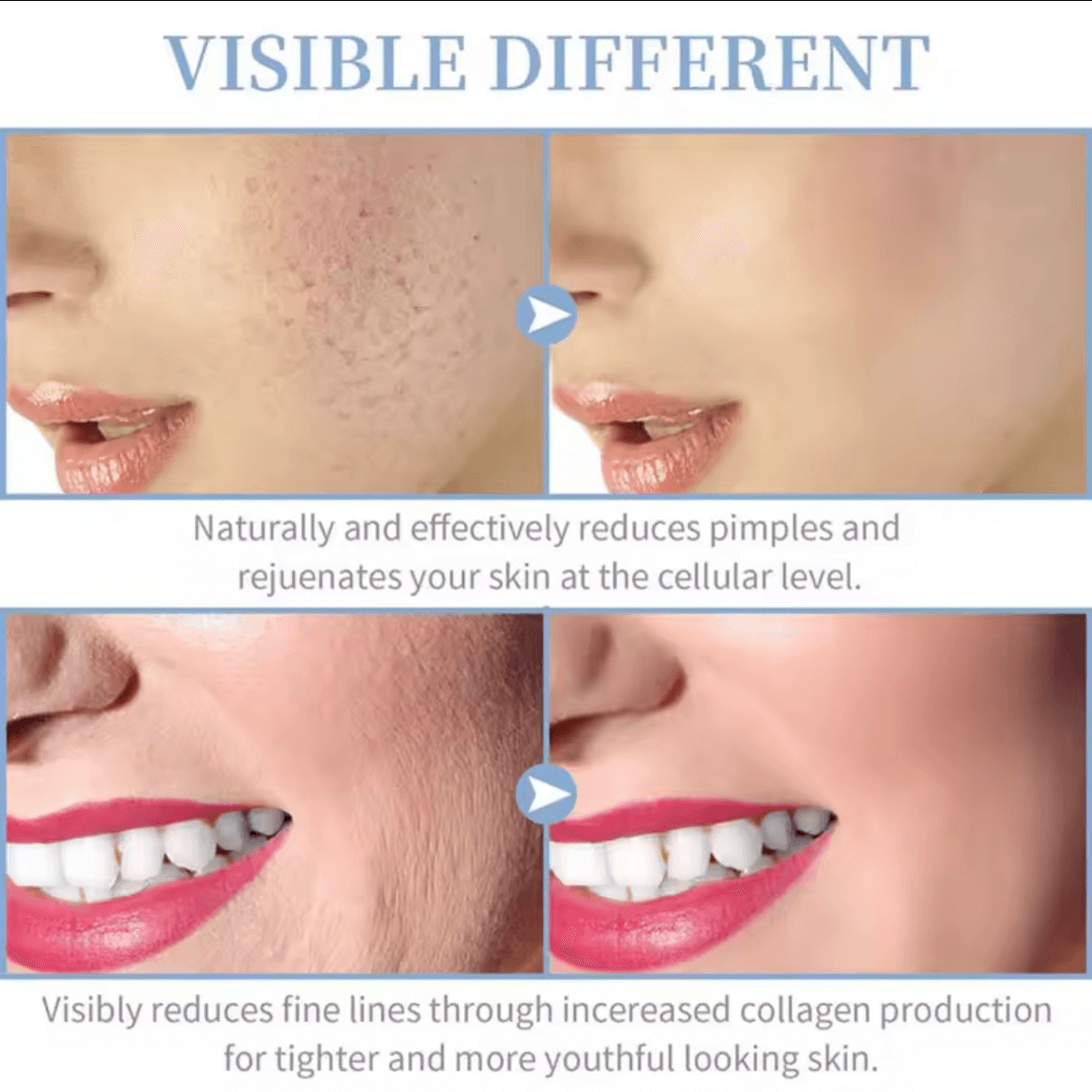 DERMAVOLT HF PRO™ - RADIANCE WAND